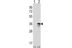 Western Blotting (WB) image for anti-U2 Small Nuclear RNA Auxiliary Factor 1 (U2AF1) antibody (ABIN3001639)