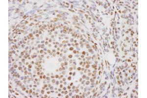 Immunohistochemistry (IHC) image for anti-Proline-, Glutamic Acid- and Leucine-Rich Protein 1 (PELP1) (AA 1000-1050) antibody (ABIN7448722) (PELP1 anticorps  (AA 1000-1050))