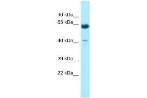 WB Suggested Anti-KRT9 Antibody Titration: 1.