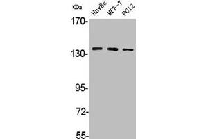 Western Blot analysis of HuvEc MCF7 PC12 cells using A Cyclase V/VI Polyclonal Antibody (ADCY6 anticorps  (C-Term))