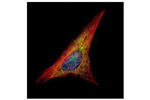 ICC/IF Image Confocal immunofluorescence analysis (Olympus FV10i) of methanol-fixed HeLa, using Gelsolin, antibody (Green) at 1:500 dilution.