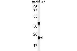 U119B Antibody (C-term) western blot analysis in mouse kidney tissue lysates (35 µg/lane). (UNC119B anticorps  (C-Term))