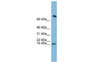 WB Suggested Anti-C1orf122 Antibody Titration: 0. (C1orf122 anticorps  (N-Term))
