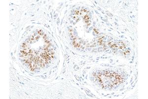 Immunohistochemistry (IHC) image for anti-Estrogen Receptor 1 (ESR1) antibody (ABIN7455134) (Estrogen Receptor alpha anticorps)