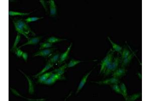 Immunofluorescent analysis of Hela cells using ABIN7142664 at dilution of 1:100 and Alexa Fluor 488-congugated AffiniPure Goat Anti-Rabbit IgG(H+L)