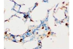Immunohistochemical analysis of paraffin-embedded rat tissue sections (lung), staining SOCS1 in nucleus, DAB chromogenic reaction (SOCS1 anticorps  (C-Term))