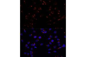 Immunofluorescence analysis of C6 cells using GOLG antibody (ABIN7267496) at dilution of 1:100.