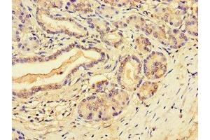 Immunohistochemistry of paraffin-embedded human pancreatic tissue using ABIN7168622 at dilution of 1:100 (SLFN11 anticorps  (AA 670-821))
