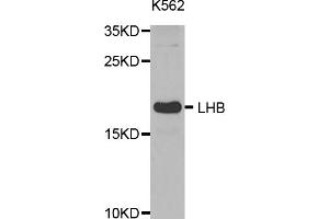 Western blot analysis of extracts of K-562 cells, using LHB antibody (ABIN5971542) at 1:400 dilution. (LHB anticorps)