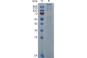 Mouse VWF (23-2813) Protein, His Tag on SDS-PAGE under reducing condition.