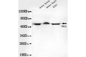 Western blot detection of TBLR1 in Mouse brain,Mouse heart and K562 cell lysates using TBLR1 mouse mAb (1:1000 diluted). (TBL1XR1 anticorps)