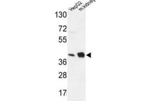 Western Blotting (WB) image for anti-NADH Dehydrogenase (Ubiquinone) 1 alpha Subcomplex, 10, 42kDa (NDUFA10) antibody (ABIN3004309) (NDUFA10 anticorps)