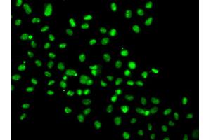 Immunofluorescence analysis of MCF-7 cells using HMG20A antibody (ABIN5974388). (HMG20A anticorps)