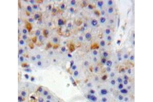 Used in DAB staining on fromalin fixed paraffin-embedded Liver tissue (LDLR anticorps  (AA 497-742))