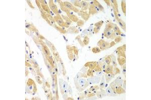 Immunohistochemistry of paraffin-embedded mouse heart using PCBP2 antibody. (PCBP2 anticorps)