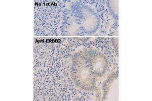 Immunohistochemistry (IHC) image for anti-Receptor tyrosine-protein kinase erbB-2 (ErbB2/Her2) (C-Term) antibody (ABIN6254225) (ErbB2/Her2 anticorps  (C-Term))