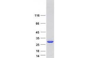 Validation with Western Blot