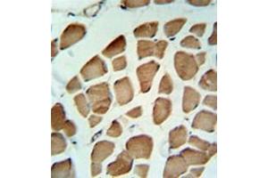 Immunohistochemistry analysis in formalin fixed and paraffin embedded skeletal muscle reacted with PDK2 Antibody  followed by peroxidase conjugation of the secondary antibody and DAB staining. (PDK2 anticorps)