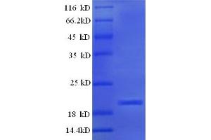 SDS-PAGE (SDS) image for Interleukin 1, beta (IL1B) (AA 114-266) protein (His tag) (ABIN5709739)