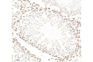 Immunohistochemistry analysis of paraffin-embedded rat testis using,PQBP1 (ABIN7075126) at dilution of 1: 6000