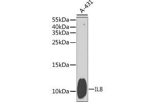 Western blot analysis of extracts of A-431 cells using IL8 Polyclonal Antibody at dilution of 1:1000. (IL-8 anticorps)