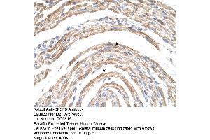 Rabbit Anti-CPSF6 Antibody  Paraffin Embedded Tissue: Human Muscle Cellular Data: Skeletal muscle cells Antibody Concentration: 16. (CPSF6 anticorps  (Middle Region))