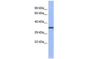 Image no. 1 for anti-Wingless-Type MMTV Integration Site Family, Member 4 (WNT4) (AA 143-192) antibody (ABIN6742254) (WNT4 anticorps  (AA 143-192))