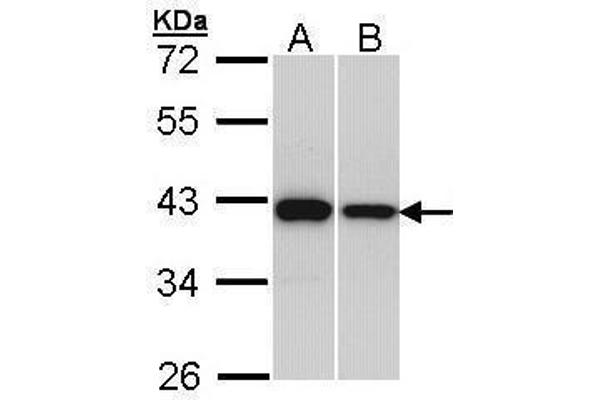 RAD51 anticorps  (Center)