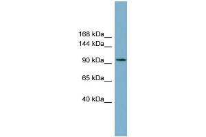 WB Suggested Anti-SLC12A3 Antibody Titration:  0. (SLC12A3 anticorps  (Middle Region))