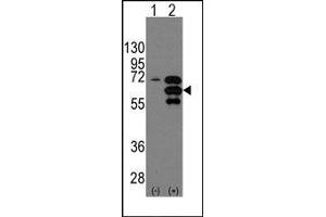 Image no. 1 for anti-Internexin Neuronal Intermediate Filament Protein, alpha (INA) (Middle Region) antibody (ABIN358797)