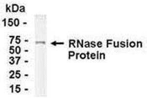 Western Blotting (WB) image for anti-Ribonuclease, RNase A Family, 1 (Pancreatic) (RNASE1) (AA 1-156) antibody (ABIN2468182) (RNASE1 anticorps  (AA 1-156))