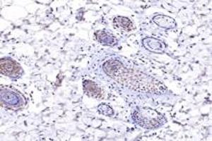 Immunohistochemistry analysis of paraffin-embedded rat skin using,NUP133 (ABIN7074909) at dilution of 1: 4800