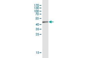 Western Blot detection against Immunogen (45. (EFCAB11 anticorps  (AA 1-163))