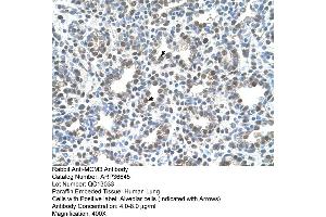 Human Lung (MCM3 anticorps  (C-Term))