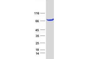 Validation with Western Blot
