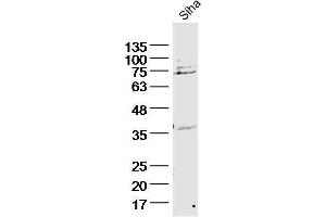 Siha lysates probed with Cytokeratin 2e Polyclonal Antibody, unconjugated  at 1:300 overnight at 4°C followed by a conjugated secondary antibody for 60 minutes at 37°C.
