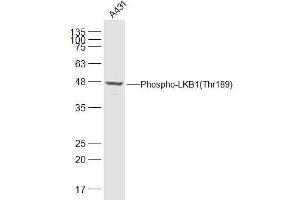 A431 lysates probed with LKB1(Thr189) Polyclonal Antibody, Unconjugated  at 1:500 dilution and 4˚C overnight incubation. (LKB1 anticorps  (pThr189))