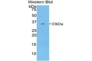 Western blot analysis of recombinant Human ROR1.