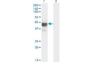 Western Blot analysis of MAGEB1 expression in transfected 293T cell line by MAGEB1 monoclonal antibody (M09), clone 3C1. (MAGEB1 anticorps  (AA 86-195))