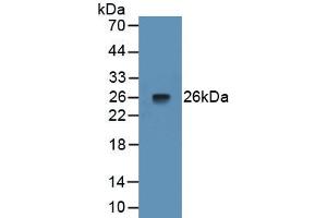 Detection of Recombinant PTX3, Rat using Monoclonal Antibody to Pentraxin 3, Long (PTX3) (PTX3 anticorps  (AA 195-381))