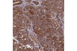 Immunohistochemical staining of human pancreas with ZNF646 polyclonal antibody  shows strong cytoplasmic and membranous positivity in exocrine glandular cells at 1:500-1:1000 dilution. (ZNF646 anticorps)