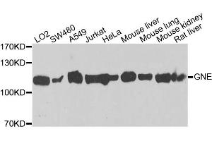 Western blot analysis of extracts of various cell lines, using GNE antibody. (GNE anticorps)