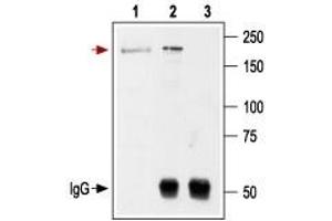 Immunoprecipitation of rat brain lysates: - 1.
