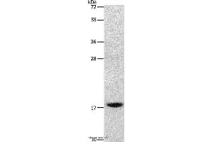 Western blot analysis of Mouse stomach tissue, using GRP Polyclonal Antibody at dilution of 1:1000 (Gastrin-Releasing Peptide anticorps)