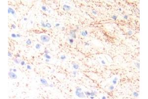Detection of IL13 in Human Brain Tissue using Polyclonal Antibody to Interleukin 13 (IL13) (IL-13 anticorps  (AA 25-146))