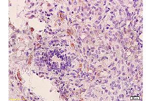 anti-Fms-Related tyrosine Kinase 1 (VEGFR1) (FLT1) (AA 1162-1260) antibody
