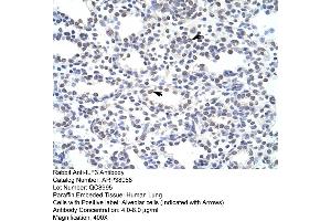 Human Lung (Interleukin enhancer-binding factor 3 (ILF3) (N-Term) anticorps)