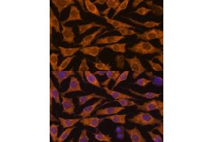 Immunofluorescence analysis of L929 cells using ZC3H7A antibody (ABIN6131068, ABIN6150400, ABIN6150401 and ABIN6217095) at dilution of 1:100.