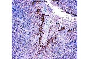 IHC-P: Profilin 2 antibody testing of human tonsil tissue (PFN2 anticorps  (C-Term))