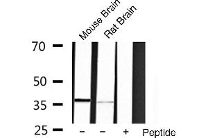 Western blot analysis of extracts of various cell lines,using OCT3 antibody. (OCT4 anticorps  (Internal Region))